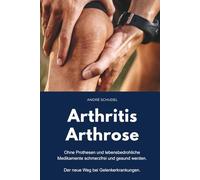 Arthritis - Arthrose. Ohne Prothesen und lebensbedrohliche Medikamente schmerzfrei und gesund werden. Der neue Weg bei Gelenkerkrankungen: Was hilft konkret bei Arthritis und/oder Arthrose?
