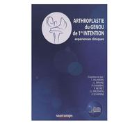 Arthroplastie Du Genou De Première Intention - Expériences Cliniques