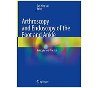 Arthroscopy And Endoscopy Of The Foot And Ankle