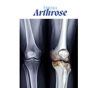 Arthrose kompakt. Praxisnahes Lern- und Nachschlagebuch mit Fallbeispielen, Quizfragen & Platz für Notizen: Alles Wichtige zu Arthrose auf einen ... Lerntipps, Eselsbrücken und Quizfragen