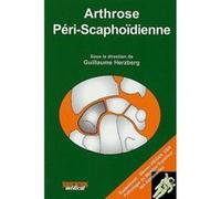 Arthrose peri scaphoidienne Herzberg (Auteur), Guillaume Herzberg (Direction)