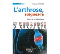 Arthrose, soignez-la