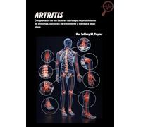 Artritis: Comprensión de los factores de riesgo, reconocimiento de síntomas, opciones de tratamiento y manejo a largo plazo