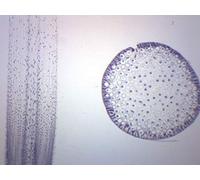 Ascaris & Onion Mitosis, toboggan préparé pour microscope - 75 x 25 mm - Mitosis végétal et animal - Microscopie d'introduction - Eisco Labs