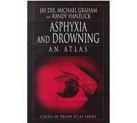 Asphyxia and Drowning, Causes of Death Atlas Series Jay Dix, Michael A. Graham, Randy Hanzlick (Auteur)