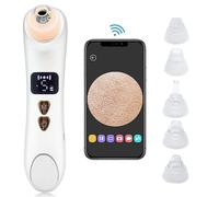 Aspirateur De Points Noirs Wi-Fi Avec Caméra ¿ 5 Niveaux D'aspiration, 6 Embouts, Charge Usb Pour Une Peau Nette