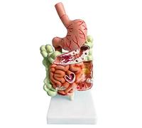 Asyduey Modèle de SystèMe Digestif Humain Anatomie de L'Estomac Gros Intestin Caecum Rectum DuodéNum Modèle de Structure des Organes Internes Humains