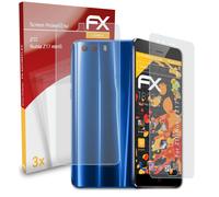 atFoliX 3x Film Protection d'écran pour ZTE Nubia Z17 miniS mat&antichoc