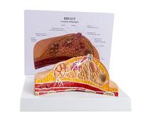 ATJSXWIN Modèle Pathologique du Sein, modèle d'Anatomie du Sein Féminin avec Carte d'Annotation