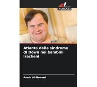 Atlante della sindrome di Down nei bambini iracheni