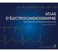 Atlas d’électrocardiographie Reconnaître l’électrocardiogramme par l’image - Inès Cibray - Publication Universite Provence - broché - Scolaire / Universitaire