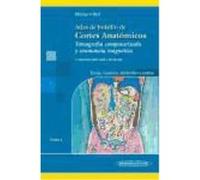 Atlas De Bolsillo De Cortes Anatómicos : Tomografía Computarizada Y Resonancia Magnética. Tomo 2, Tórax, Corazón, Abdomen Y Pelvis - Torsten B. Möller, Emil Reif Torsten B Möller, Emil Reif (Auteur)