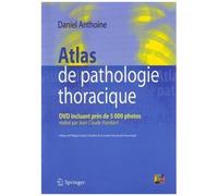 Atlas de pathologie thoracique: DVD incluant près de 5000 photos réalisé par Jean-Claude Humbert
