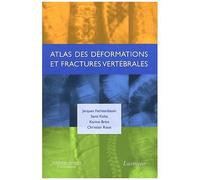 Atlas Des Déformations Et Fractures Vertébrales