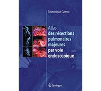 Atlas des résections pulmonaires majeures par voie endoscopique