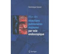 Atlas Des Résections Pulmonaires Majeures Par Voie Endoscopique