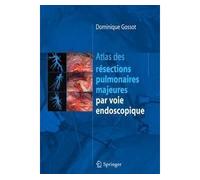 Atlas des résections pulmonaires majeures par voie endoscopique - Dominique Gossot - Springer Vienne - relié - Scolaire / Universitaire