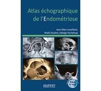 Atlas échographique de l'endométriose