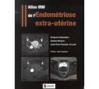 Atlas irm de l'endometriose extra-uterine Benjamin Dallaudière (Auteur), Antoine Maubon (Auteur), Jean-Pierre Rouanet de Lavit (Auteur)