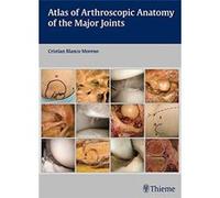 Atlas Of Arthroscopic Anatomy Of Major Joints Cristian Blanco Moreno (Auteur)