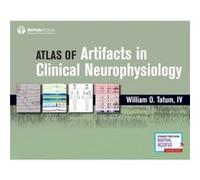 Atlas of Artifacts in Clinical Neurophysiology by William Tatum William Tatum (Auteur)