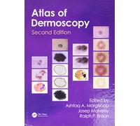 Atlas of Dermoscopy