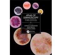 Atlas of Dermoscopy