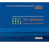 Atlas of Electroencephalography - Volume 2: The Epilepsies - EEG and epileptic syndromes