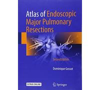 Atlas Of Endoscopic Major Pulmonary Resections