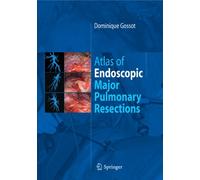 Atlas of Endoscopic Major Pulmonary Resections
