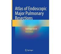 Atlas Of Endoscopic Major Pulmonary Resections