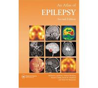 Atlas of Epilepsy