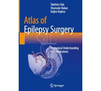 Atlas of Epilepsy Surgery: Anatomical Understanding with Illustrations