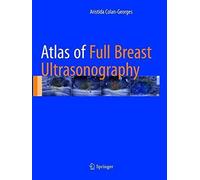 Atlas Of Full Breast Ultrasonography