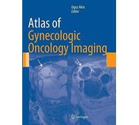 Atlas Of Gynecologic Oncology Imaging