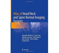 Atlas Of Head/Neck And Spine Normal Imaging Variants