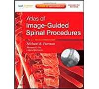Atlas Of Image - Guided Spinal Procedures