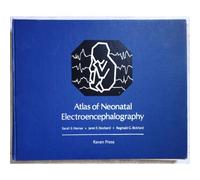 Atlas Of Neonatal Electroencephalography