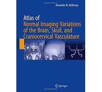 Atlas Of Normal Imaging Variations Of The Brain, Skull, And Craniocervical Vasculature