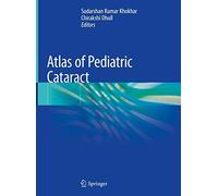 Atlas Of Pediatric Cataract