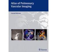 Atlas Of Pulmonary Vascular Imaging