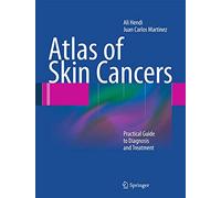 Atlas of Skin Cancers: Practical Guide to Diagnosis and Treatment