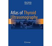 Atlas Of Thyroid Ultrasonography