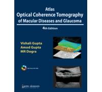 Atlas Optical Coherence Tomography Of Macular Diseases And Glaucoma