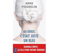 Au début, c'était juste un bleu