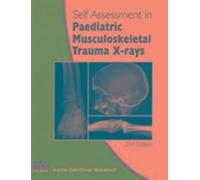 Auto-évaluation des radiographies de traumatismes musculo-squelettiques en pédiatrie