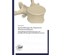 Autocalibrage de séquences thoracoscopiques - Fantin Girard - P.academiques Francophones - broché - Essai