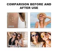 Autocollant de détection UV, patch de crème solaire, Ensemble de 24 autocollants pour le bronzage, Rappel de réapplication étanche à la crème solaire, fournitures de soins personnels pour le corps du