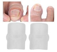 Autocollants de correction des ongles, 2pcs outil de soin des pieds correcteur d'ongle incarné en silicone pour paronychie récupérant l'outil de soin des ongles, Correcteur d'ongles incarnés