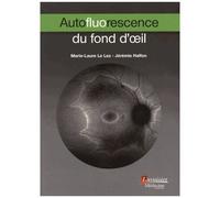 Autofluorescence Du Fond D'oeil
